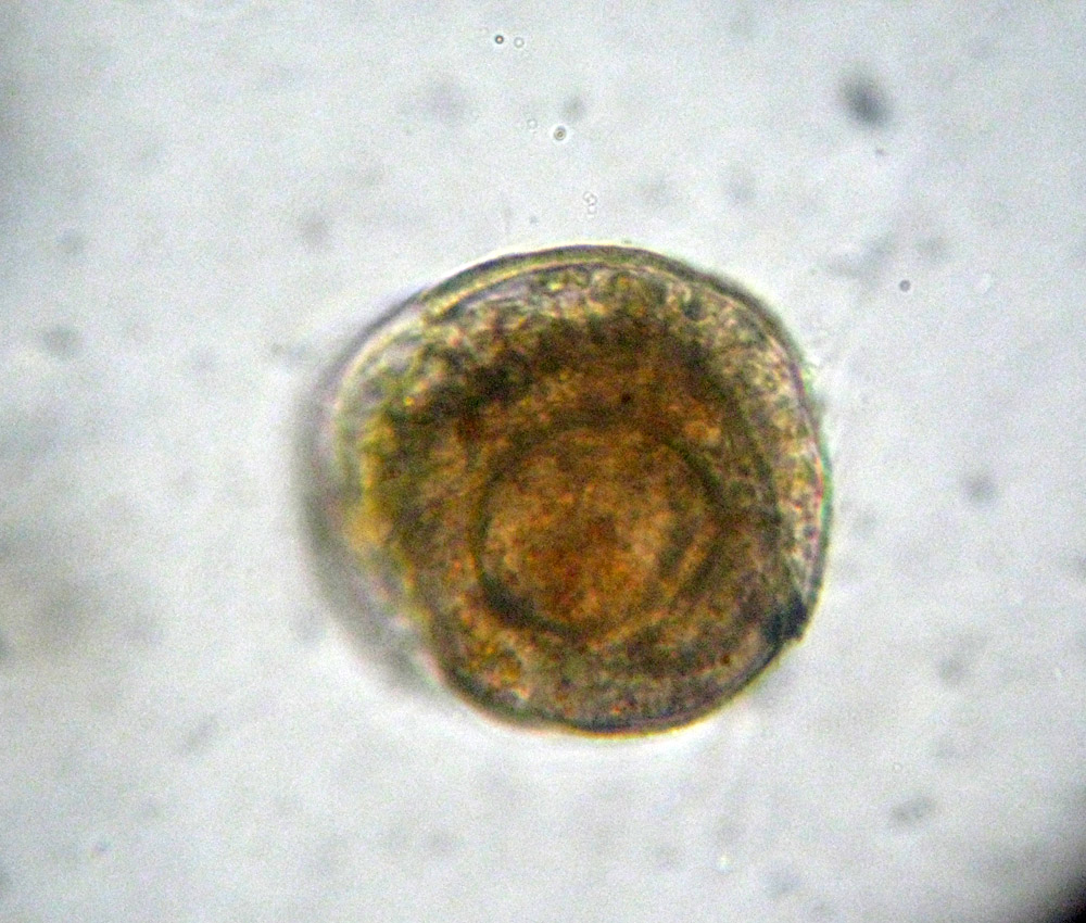 Foraminifera: probabile Glomospira gordialis